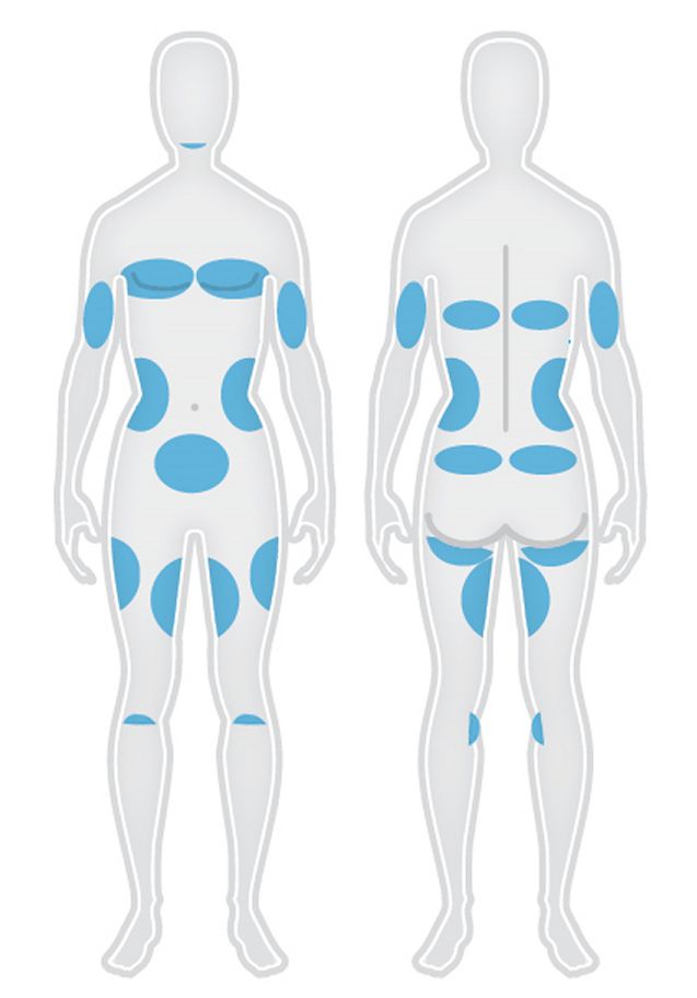 Graphic demonstrates the areas of the body that CoolSculpting can be applied by a technician at Artistry Skin and Laser.