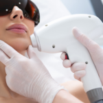 Laser Hair Removal by Artistry